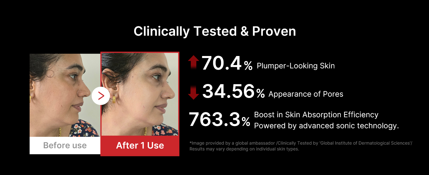 KEY BENEFITS OF BOOSTER H. KOREAN SKIN CARE DEVICE THAT MAXIMIZES SKIN CARE